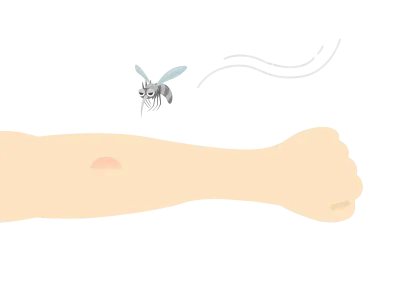 虫刺されのイラスト