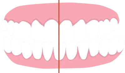 crossbite, list of orthodontic dental problem