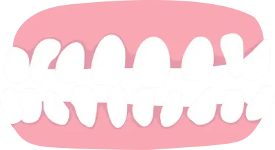 spacing, list of orthodontic dental problem