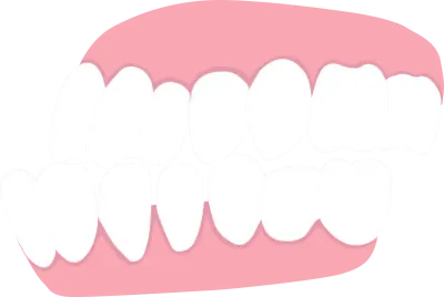 underbite, list of orthodontic dental problem