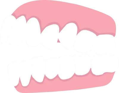 open bite, list of orthodontic dental problem