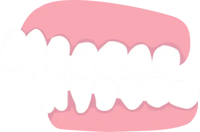 overjet, list of orthodontic dental problem