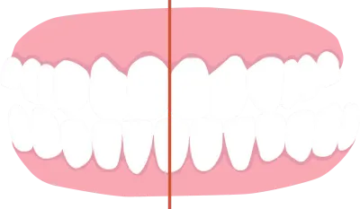 crossbite, list of orthodontic dental problem