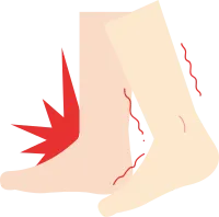 다리경련