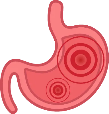 소화기 상태별 위장 일러스트