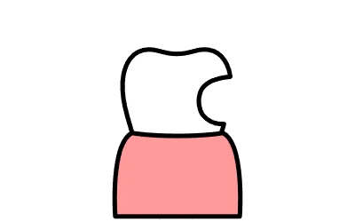 Dental Image icon of a tooth with a cavity hole, simple line drawing