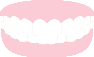Aesthetic dentistry, illustration of white teeth and pink gums