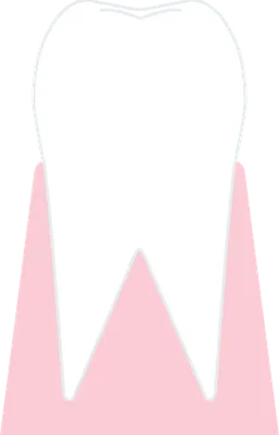 Very simple tooth cross section
