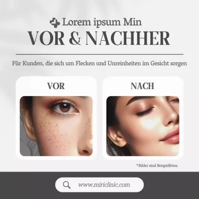 Grey, Simple Style Dermatologie Vorher & Nachher Aktionen
