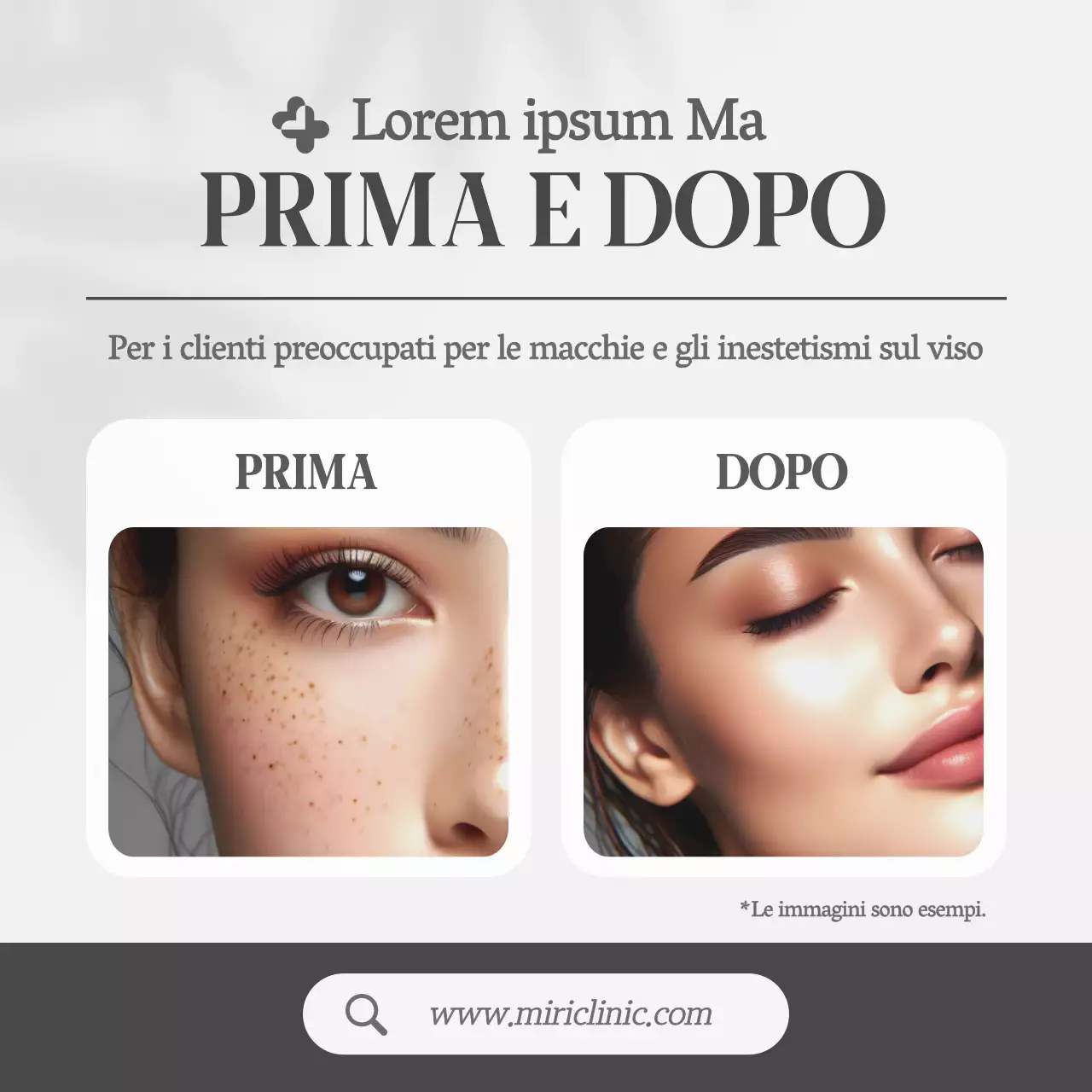 Grigio, stile semplice Dermatologia Prima e dopo le promozioni