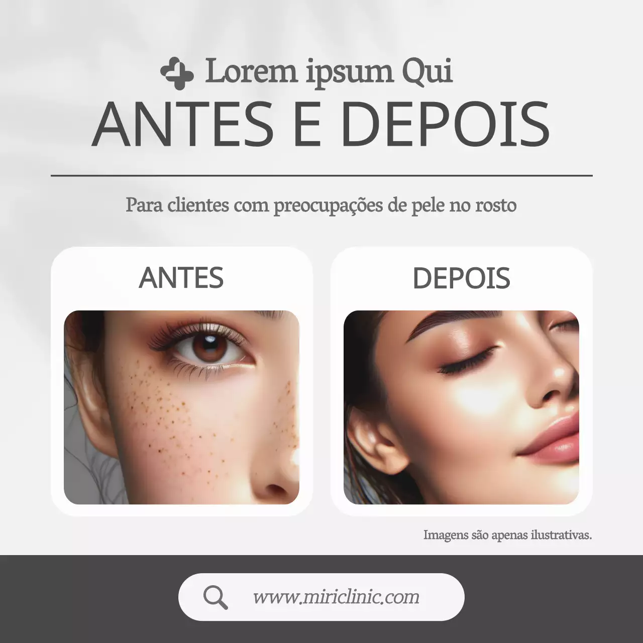 Cinzento, estilo simples Dermatologia Antes e Depois Promoções
