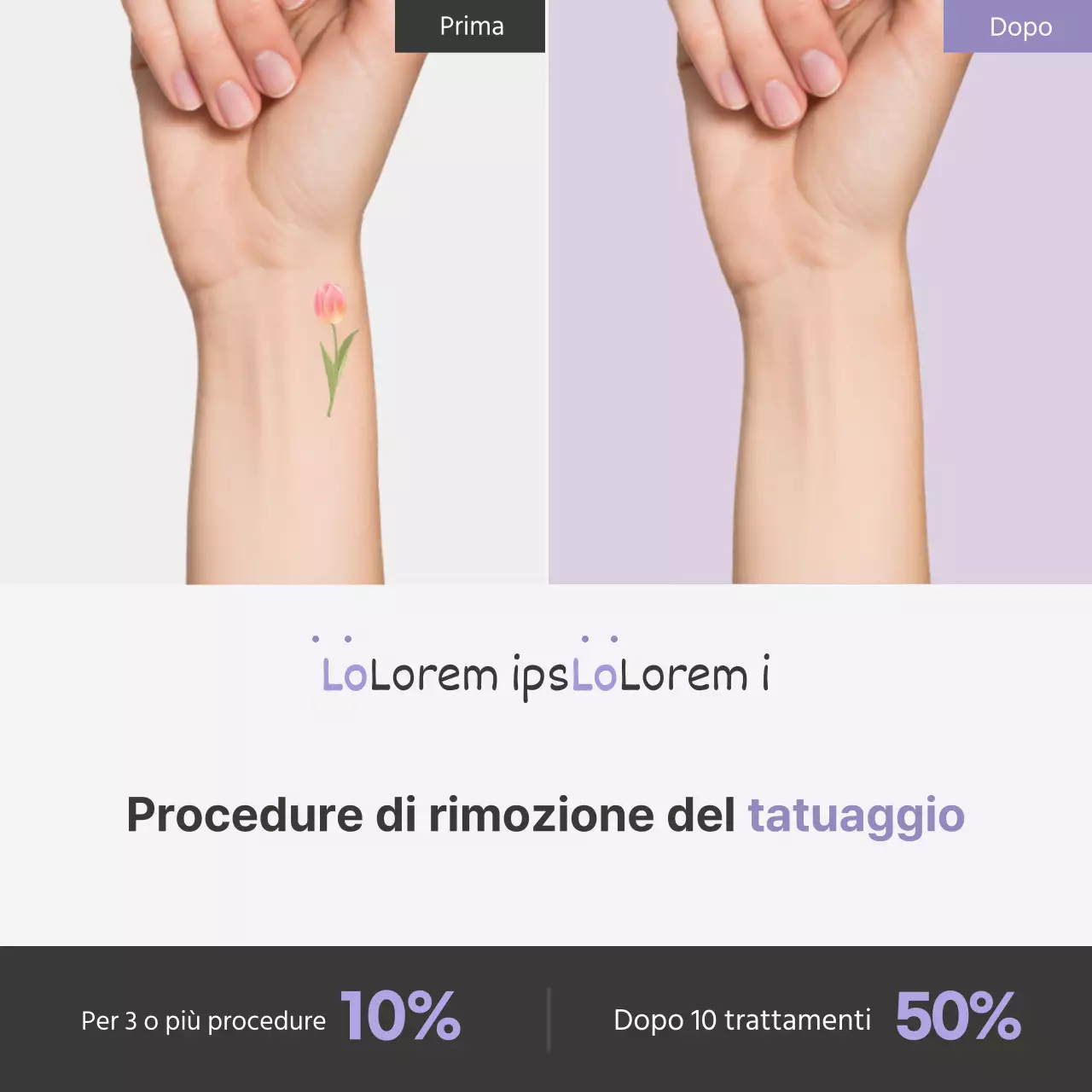 Promuovere la semplice procedura di rimozione dei tatuaggi di Lavender Point