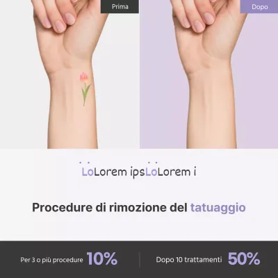 Promuovere la semplice procedura di rimozione dei tatuaggi di Lavender Point
