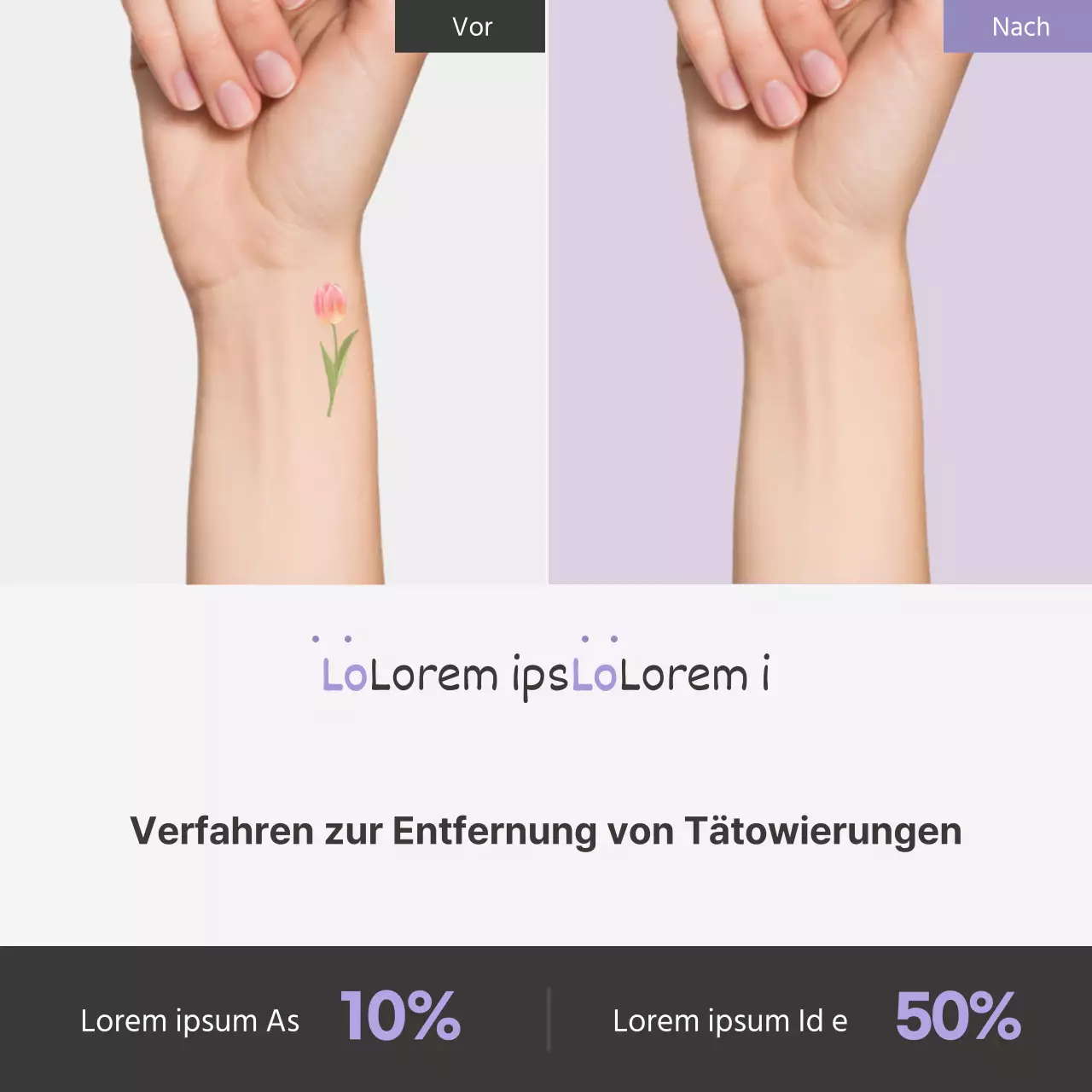 Werbung für das einfache Verfahren zur Entfernung von Tätowierungen bei Lavender Point