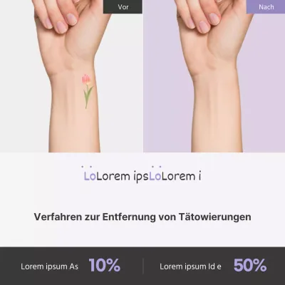 Werbung für das einfache Verfahren zur Entfernung von Tätowierungen bei Lavender Point