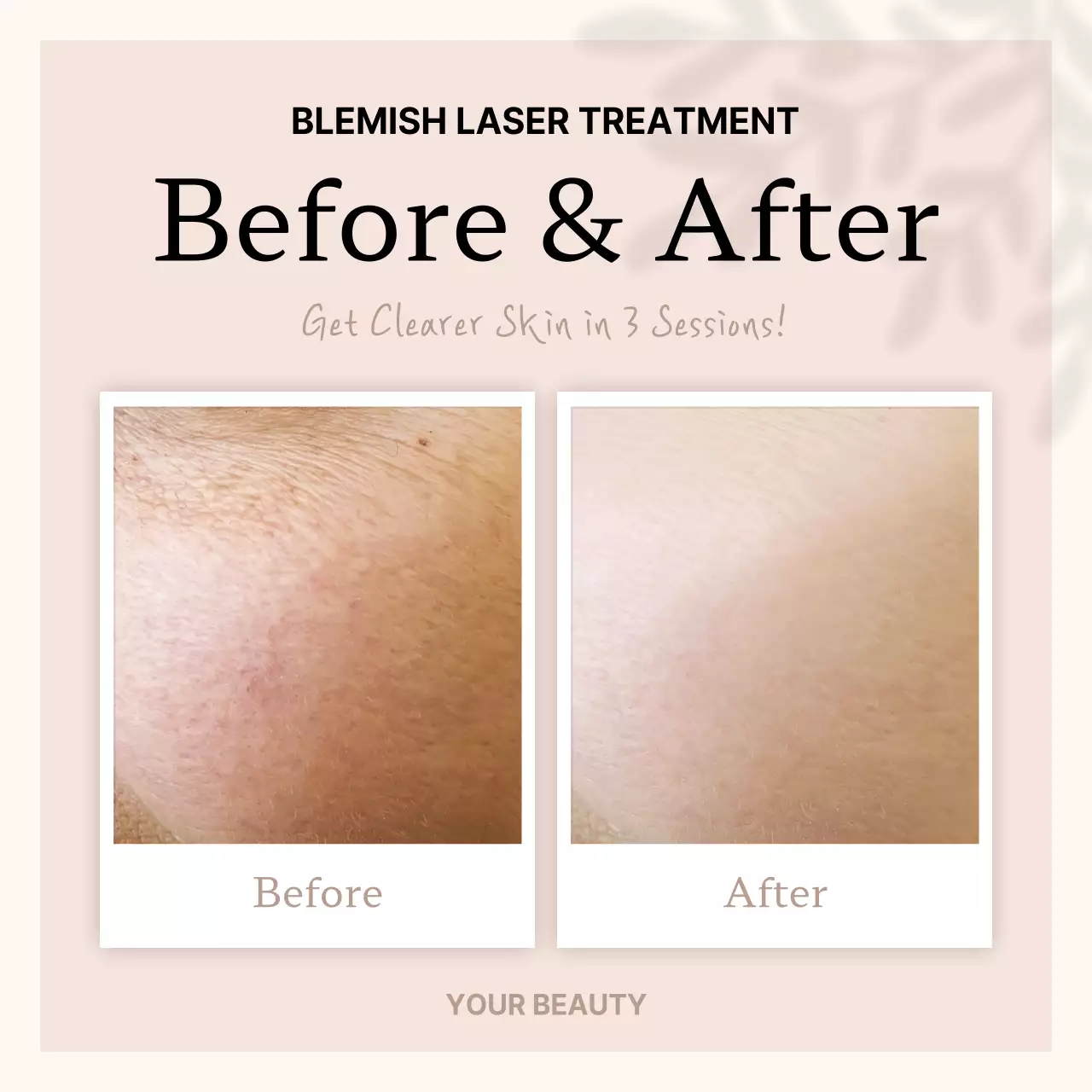 Beige Clean Skincare Promotion Social Media Post