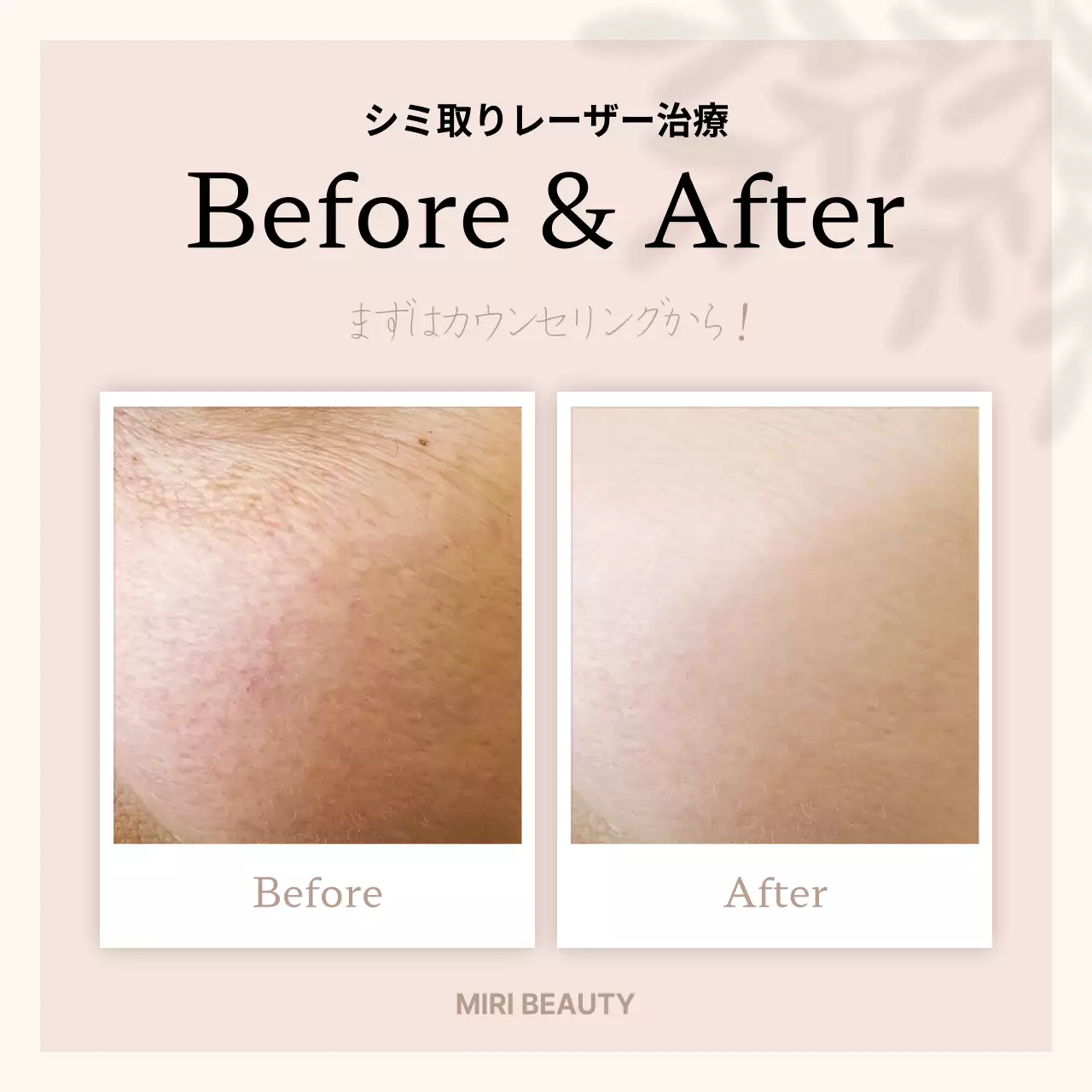 ピンク シンプル 美容 ポスター SNS投稿 正方形