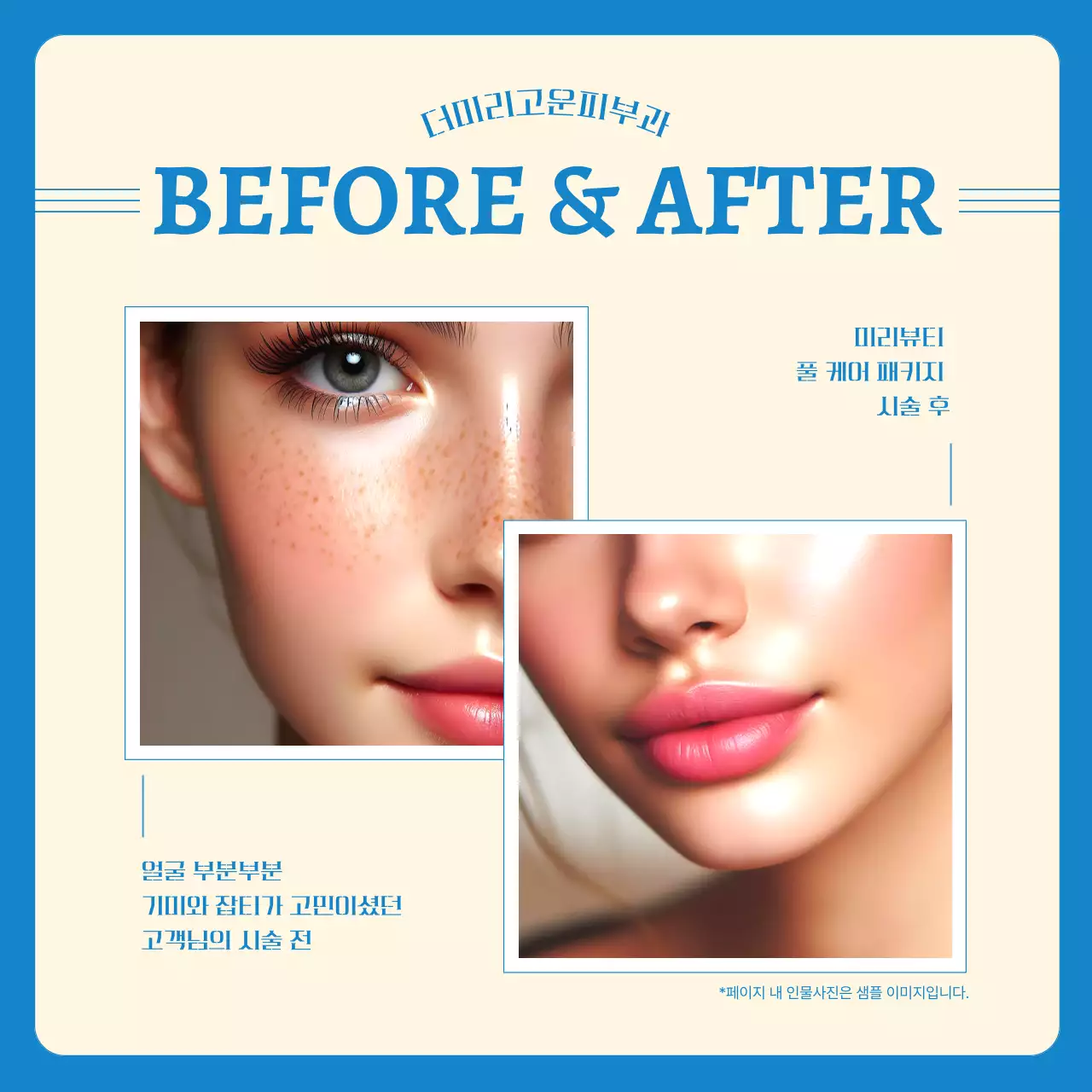 노랑과 하늘색의 심플한 피부과 시술 전후 홍보