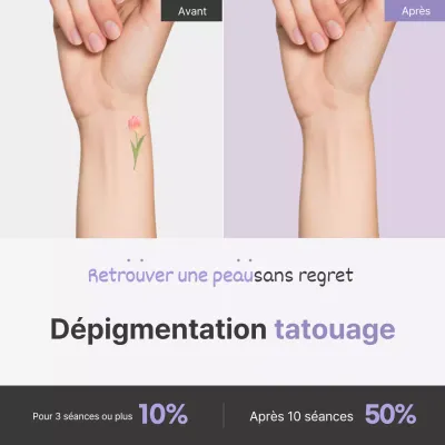 Promouvoir la procédure simple de détatouage de Lavender Point