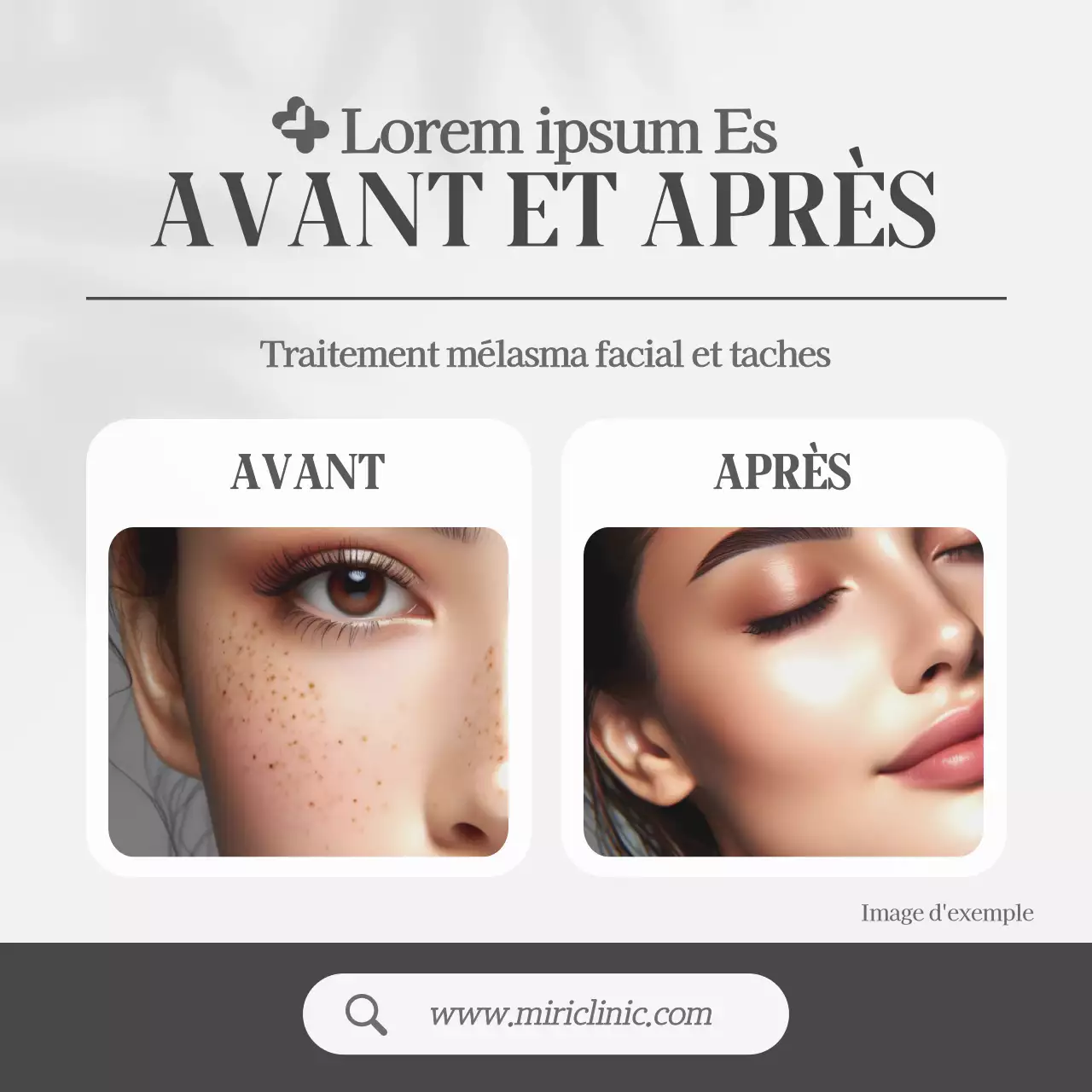 Grey, Simple Style Dermatology Promotions Avant et Après