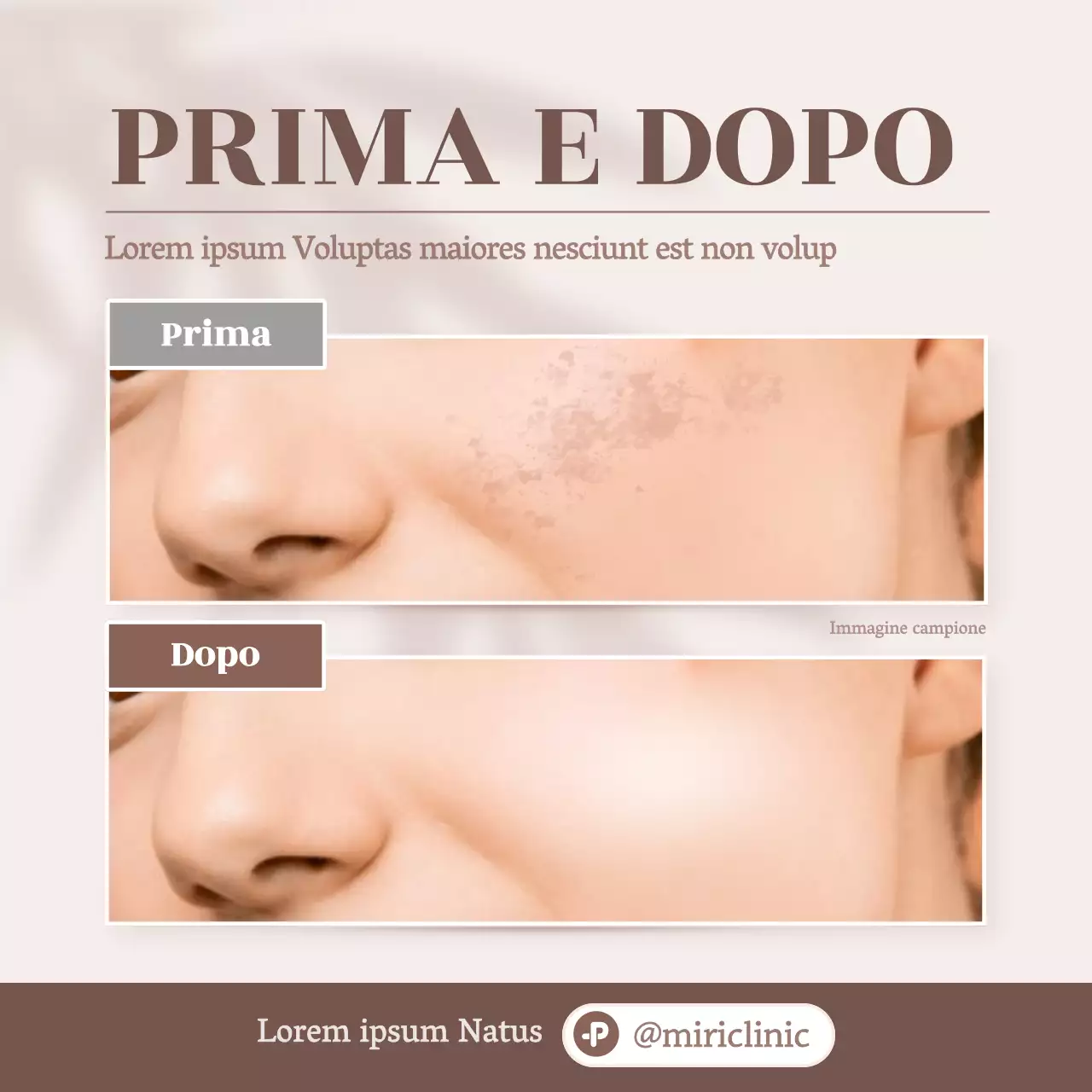 Promuovere il beige, foto di confronto di dermatologia moderna prima e dopo