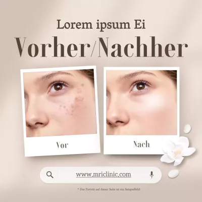 Fördern Sie beige, moderne Dermatologie vor und nach Vergleichsfotos