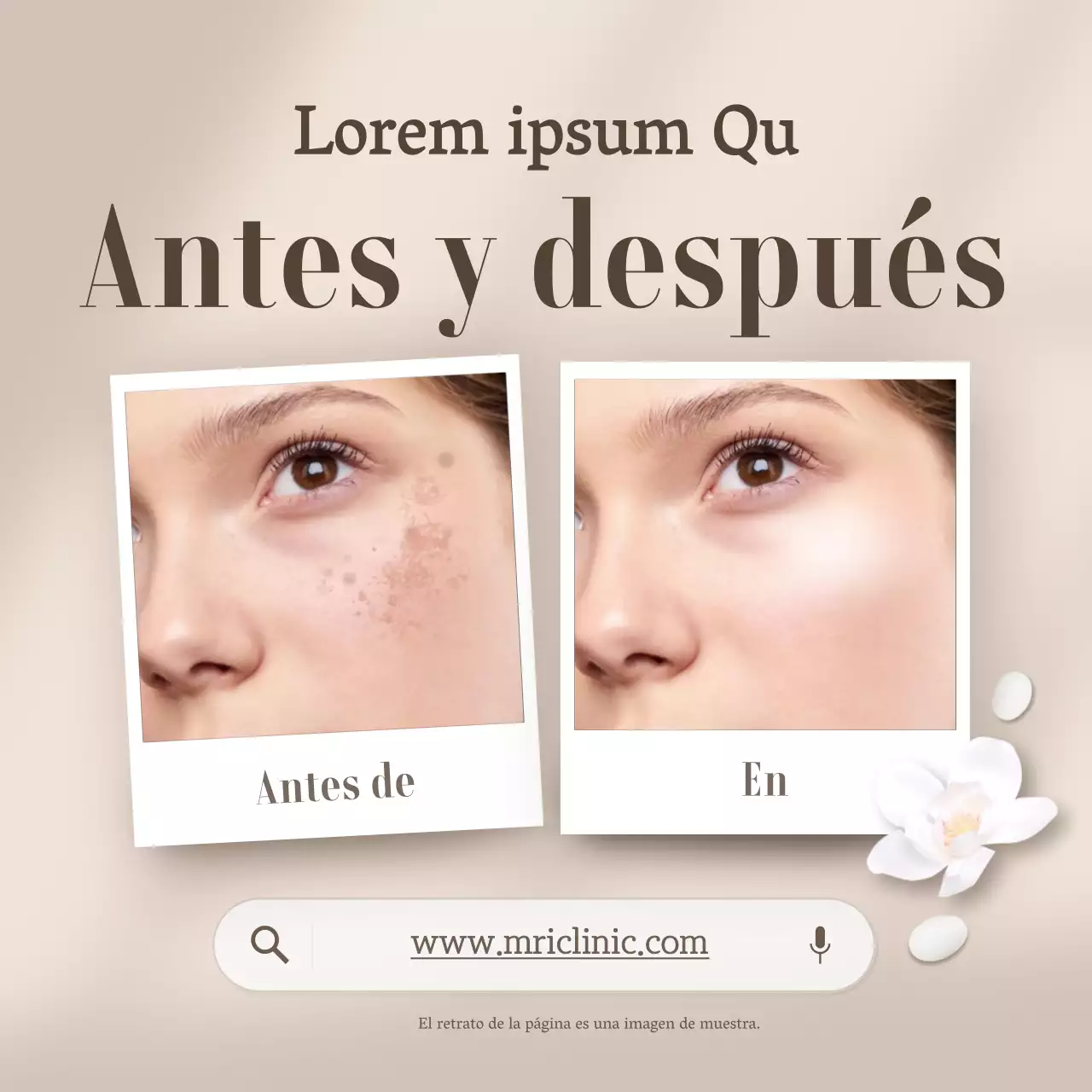 Promover beige, dermatología moderna fotos comparativas antes y después