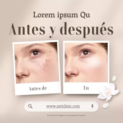 Promover beige, dermatología moderna fotos comparativas antes y después
