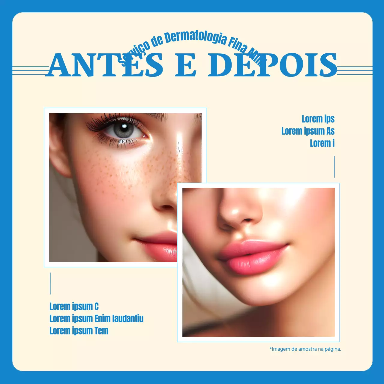 Promoção simples amarela e azul clara pré e pós-dermatologia