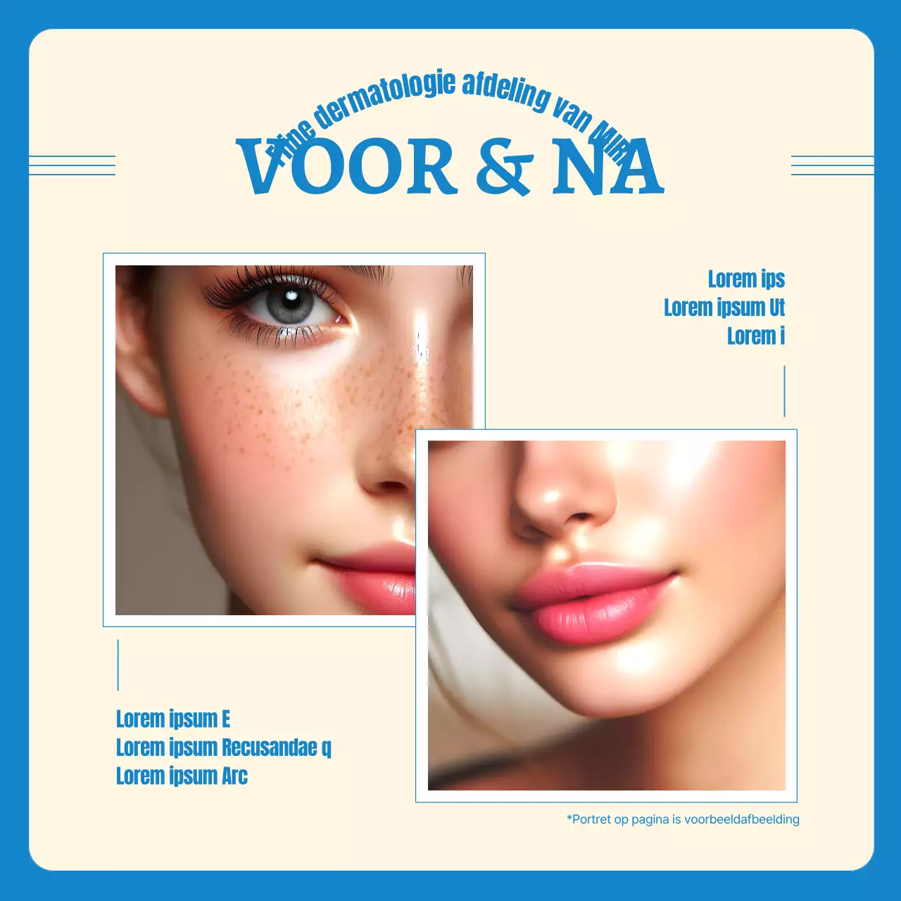 Eenvoudige gele en lichtblauwe pre- en postdermatologie promotie