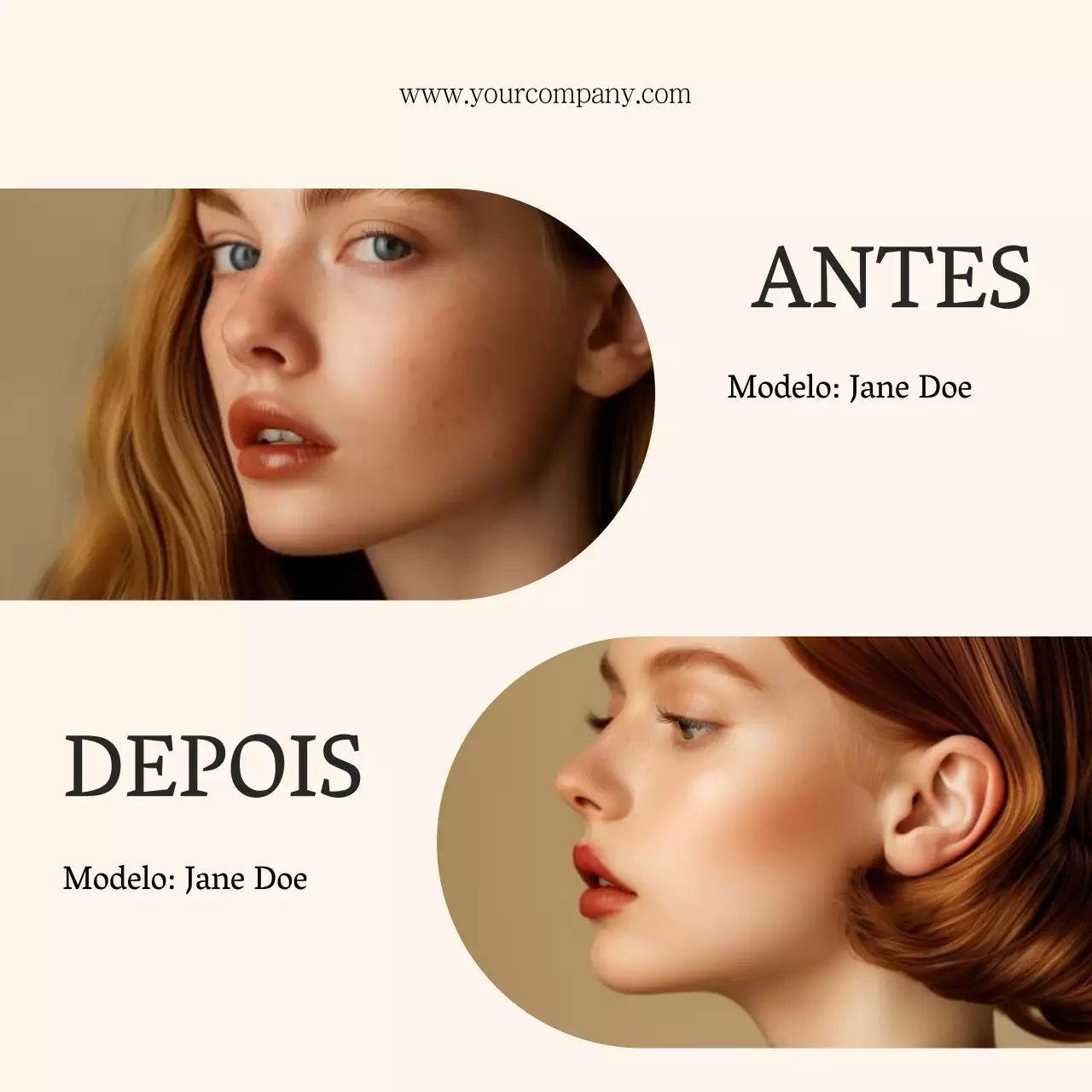 Campanha de comparação Beige Minimal Before After