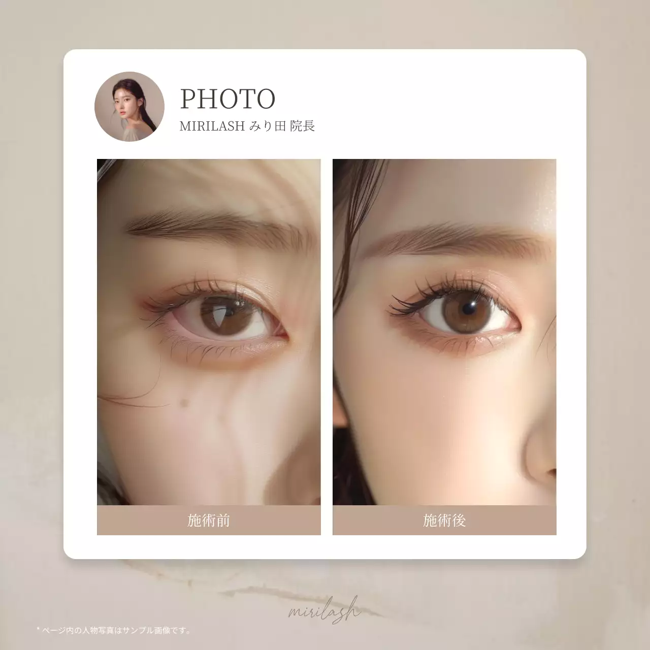 白 シンプル ビューティー 看板 Instagram カルーセル