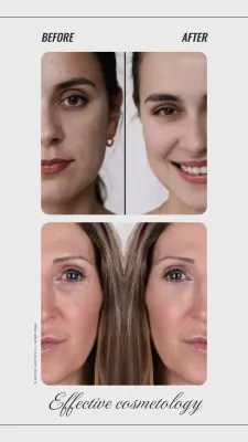 Postingan Instagram Promosi Kosmetologi Modern Putih