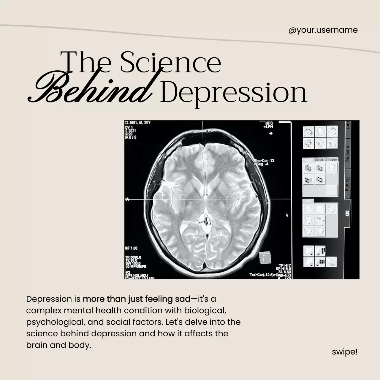 Beige Minimal Mental Health Guide Social Media Post