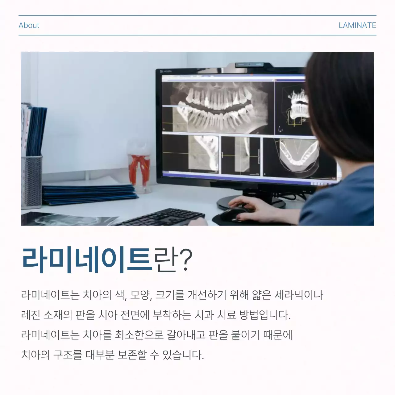 흰색과 하늘색의 심플한 치과를 홍보하기위한 병원 시술 정보 안내 홍보