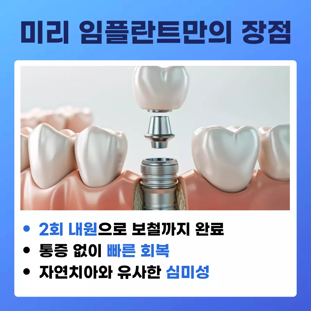 파랑의 심플한 임플란트 치과 홍보