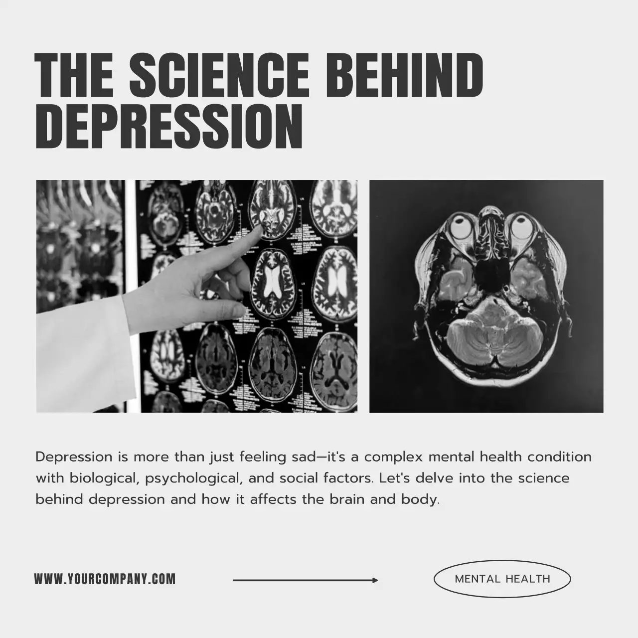 Grey Minimalist Mental Health Guide Social Media Post