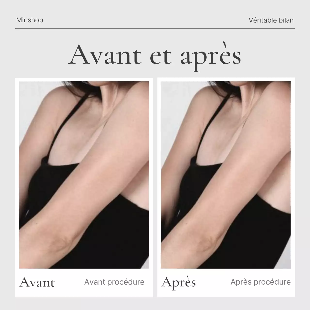 Promouvoir un flux de médias sociaux tendance en beige et gris