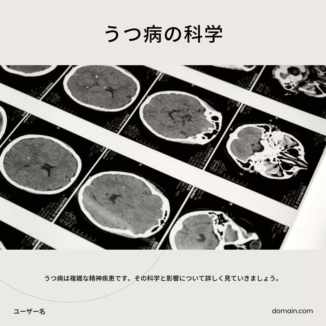 白黒 シンプル メンタルヘルス プレゼンテーション SNS投稿 正方形