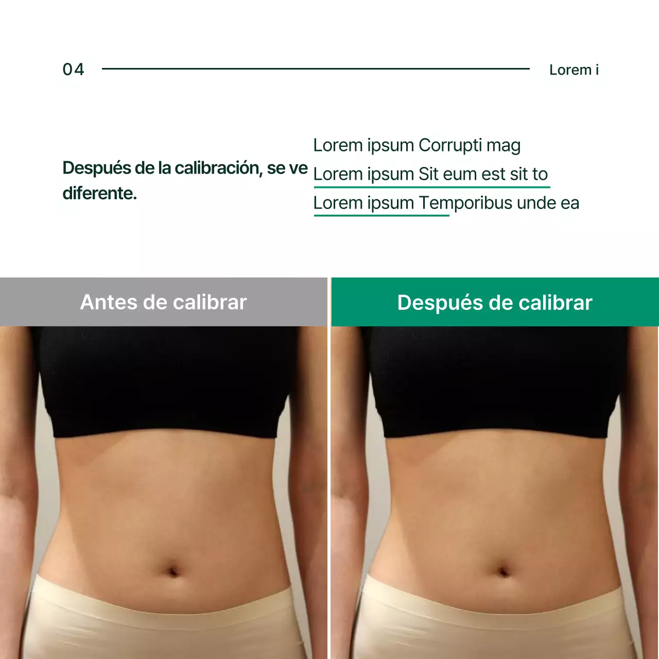 Acerca de la solución de corrección pélvica Simple Green and White