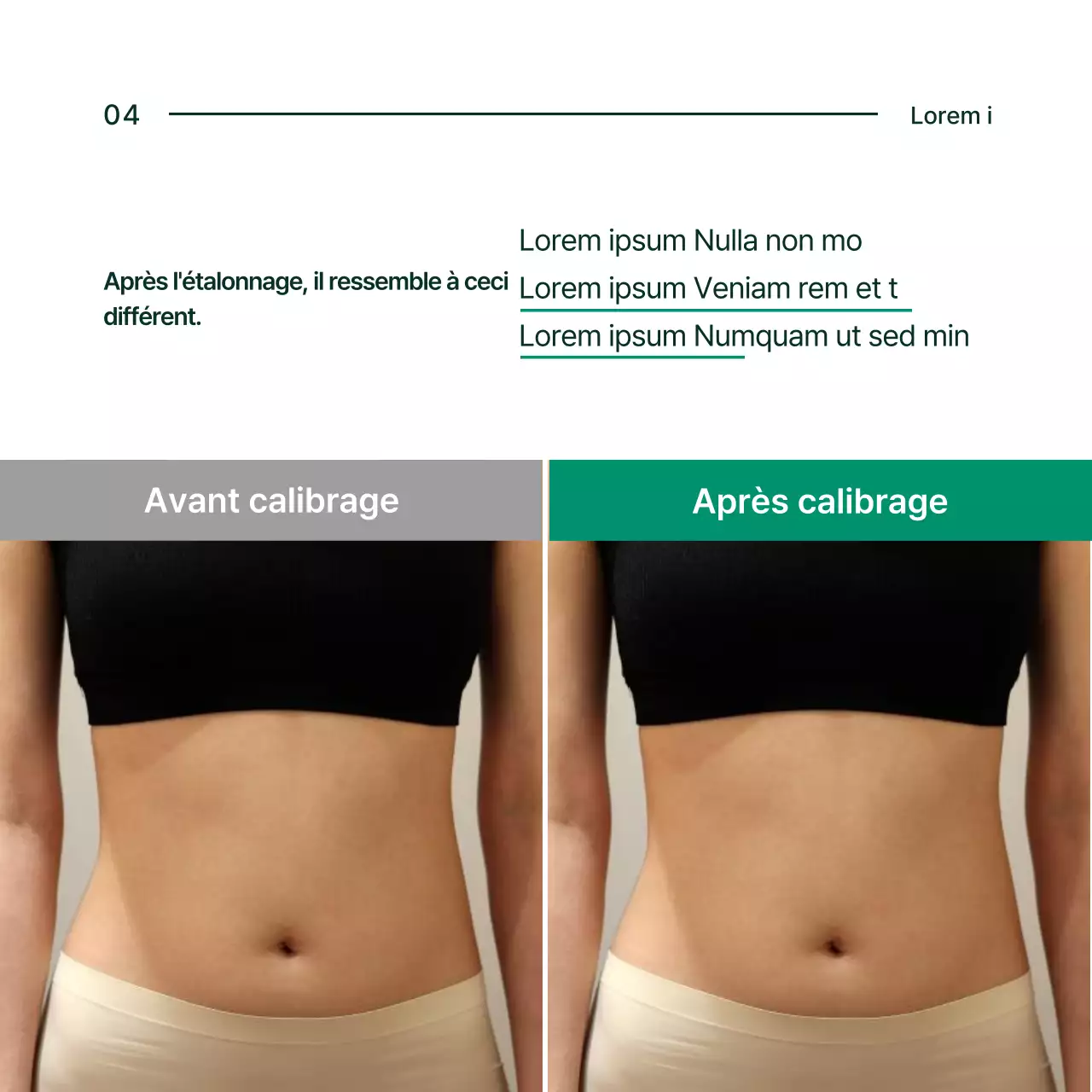 À propos de la solution simple de correction pelvienne verte et blanche