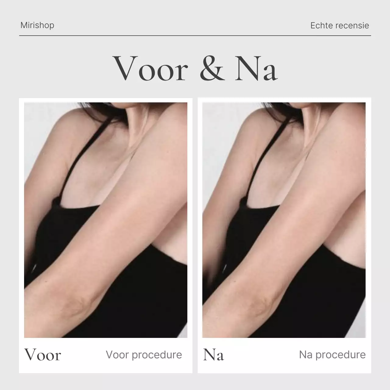 Promoot een trendy feed voor sociale-mediamarketing in beige en grijs