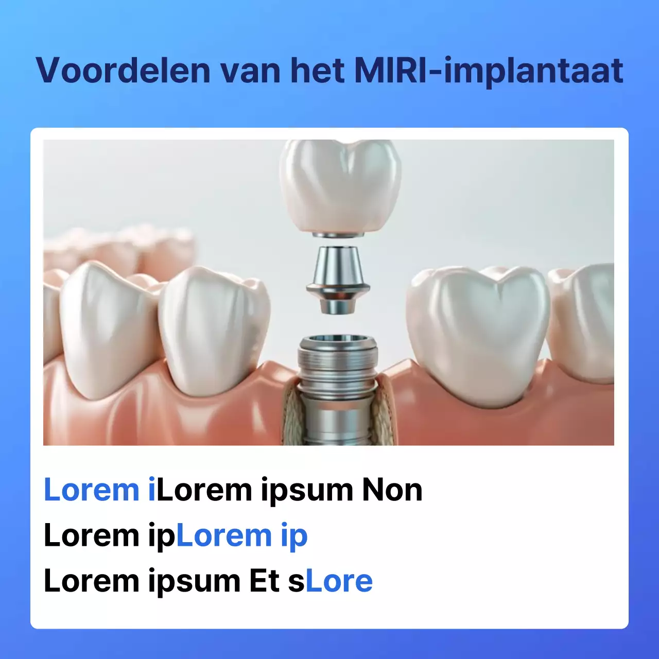 Blue's eenvoudige implantaat tandheelkunde promoties