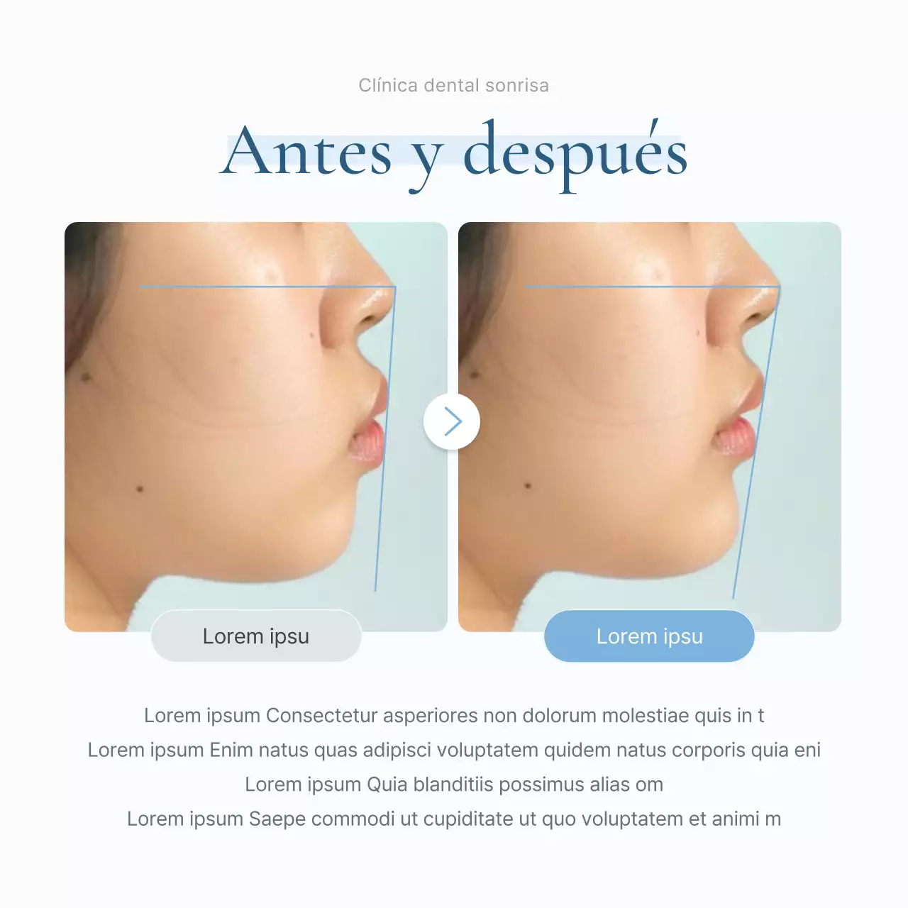 Un sencillo kit de redes sociales de marketing para consultas dentales en blanco y azul claro para promocionar la consulta.