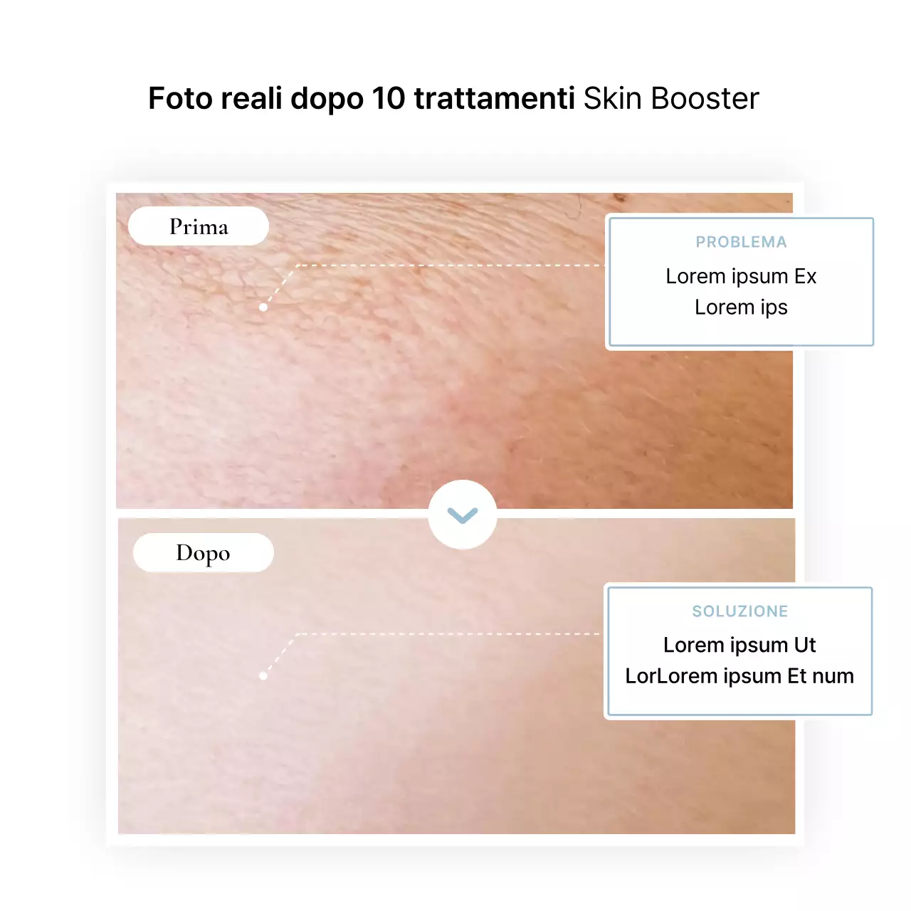 Revisione ospedaliera prima e dopo la pubblicità di un evento per promuovere un semplice studio dermatologico bianco e azzurro