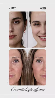 Tendance beige et grise Collage photo avant/après Promotion