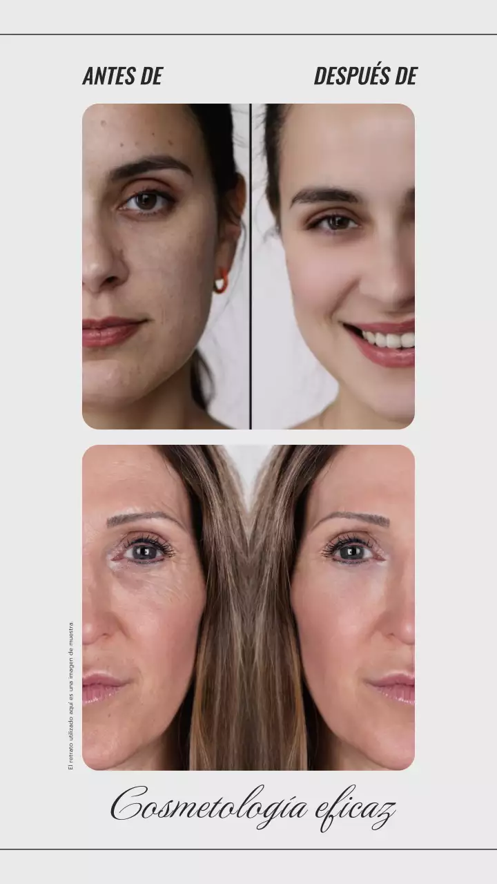 Beige y Gris Tendencia Antes Después Foto Collage Promoción