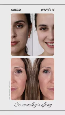 Beige y Gris Tendencia Antes Después Foto Collage Promoción