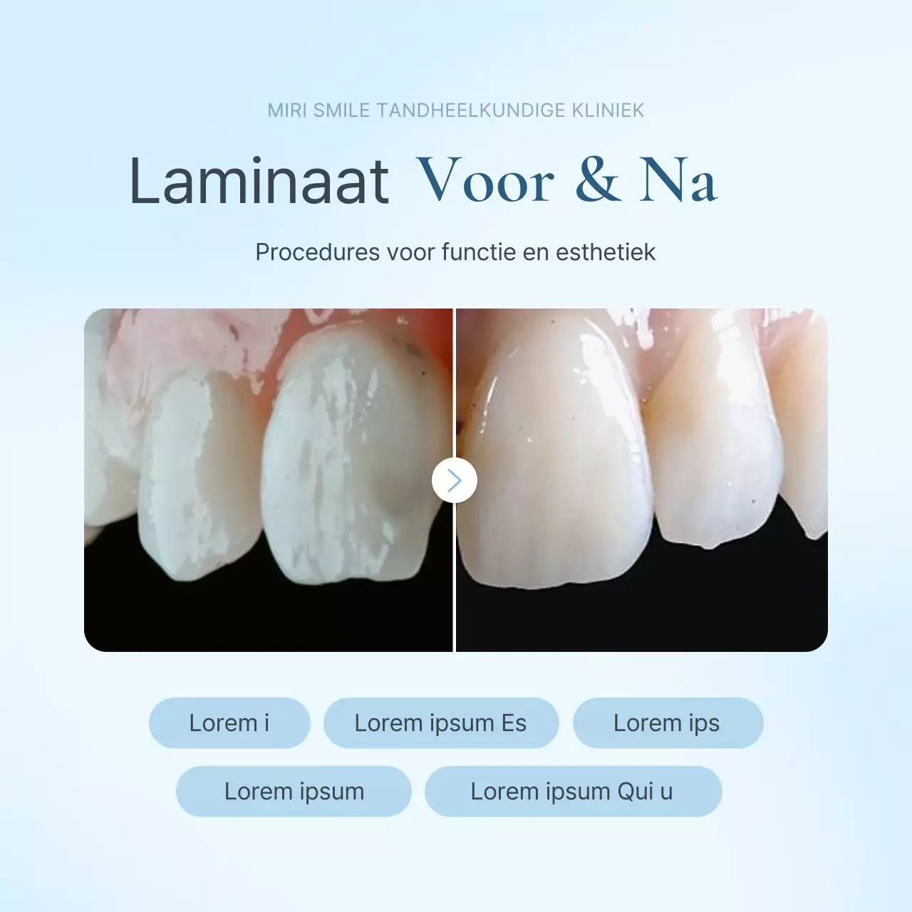 Ziekenhuisreview voor en na om een eenvoudige witte en lichtblauwe tandartspraktijk te promoten