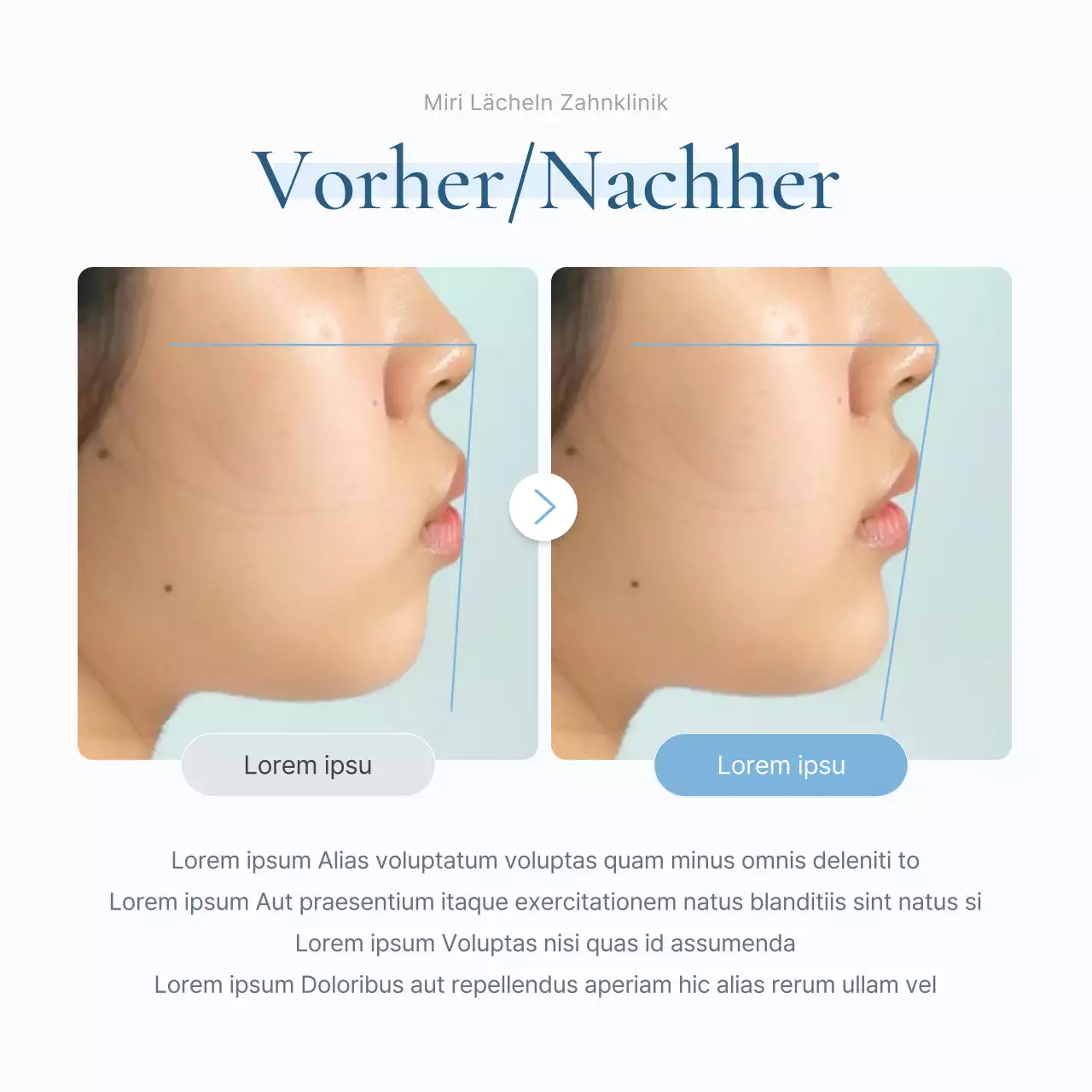 Ein einfaches weißes und hellblaues Social-Media-Kit für das Marketing einer Zahnarztpraxis, um für die Praxis zu werben.